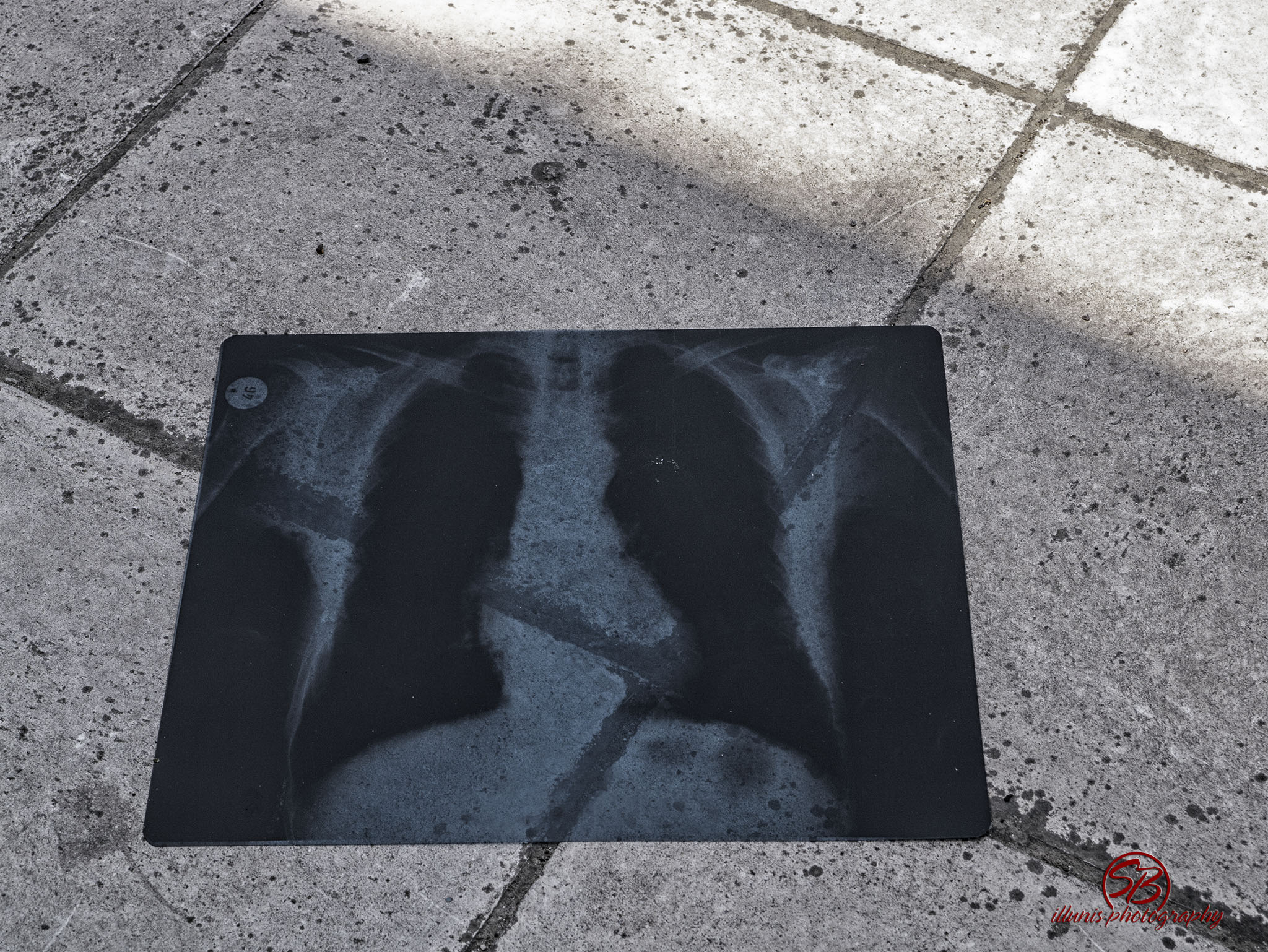 Xray